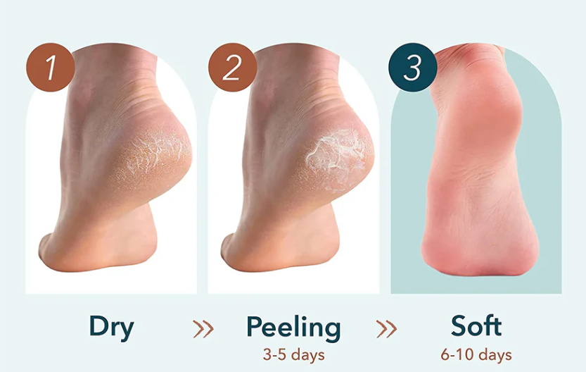 Действие маски пилинг